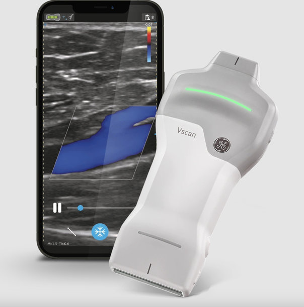 GE HEALTHCARE INTRODUCES CAPTION AI ON VSCAN AIR SL